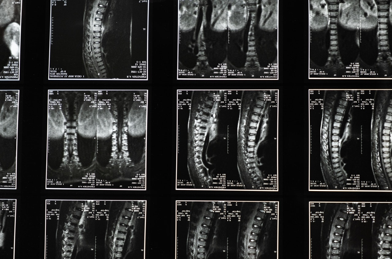 Diagnostyka obrazowa kręgosłupa – przegląd badań